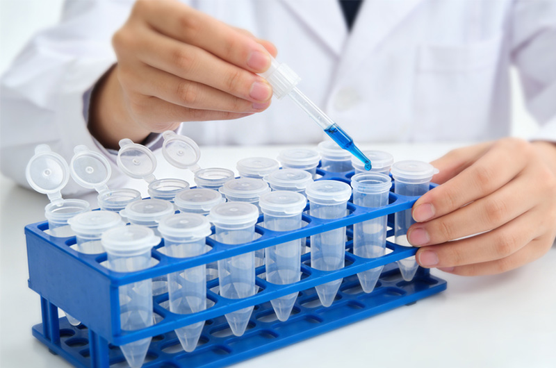 IVD-Centrifuge-Tube-Customization-Solution